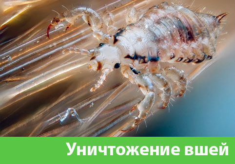 Уничтожение вшей в городе Крвсноярск